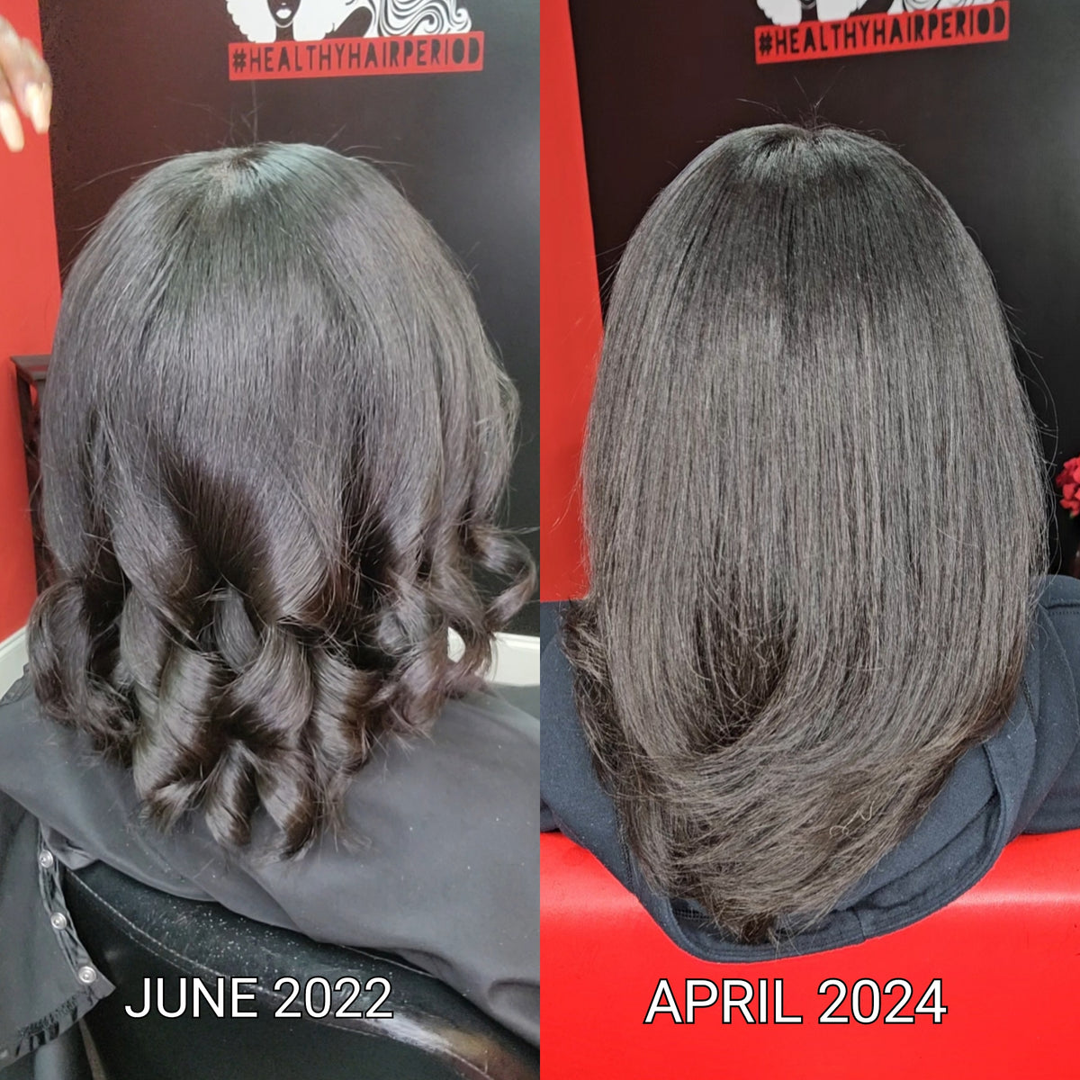 natural hair loss treatment for women