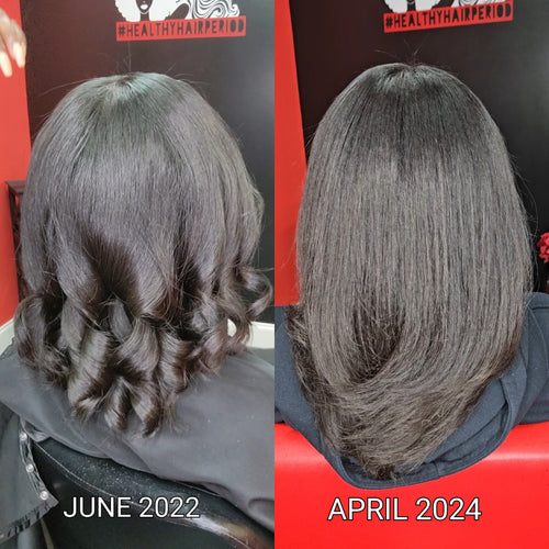 natural hair loss treatment for women
