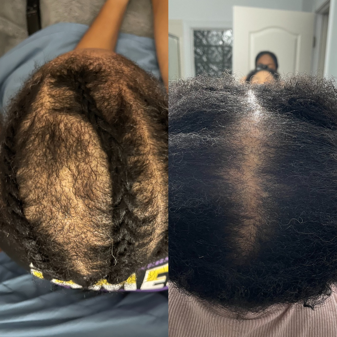biotin + collagen hair growth support